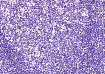 C17orf87 Rabbit Polyclonal Antibody