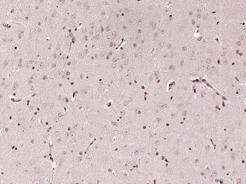 C1orf103 Rabbit Polyclonal Antibody