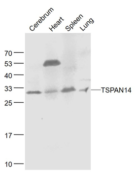 TSPAN14 Rabbit Polyclonal Antibody