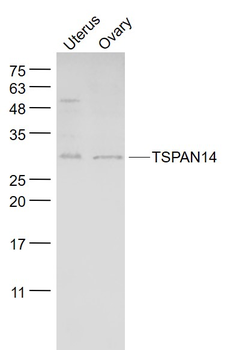 TSPAN14 Rabbit Polyclonal Antibody