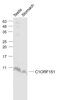 C1ORF151 Rabbit Polyclonal Antibody