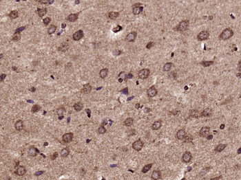 C1orf163 Rabbit Polyclonal Antibody