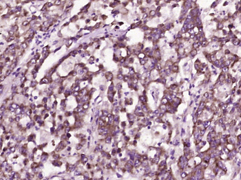 C1orf173 Rabbit Polyclonal Antibody