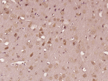 C1orf173 Rabbit Polyclonal Antibody