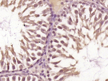 C1orf173 Rabbit Polyclonal Antibody