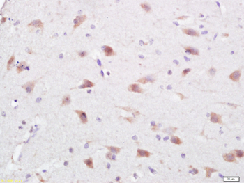 C1orf173 Rabbit Polyclonal Antibody
