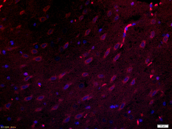 C1orf173 Rabbit Polyclonal Antibody