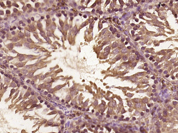 C1ORF190 Rabbit Polyclonal Antibody