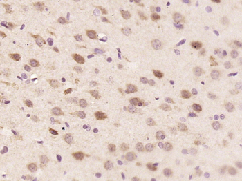 C1orf216 Rabbit Polyclonal Antibody
