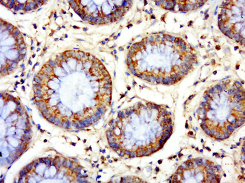 C1orf33 Rabbit Polyclonal Antibody