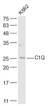 C1QA Rabbit Polyclonal Antibody