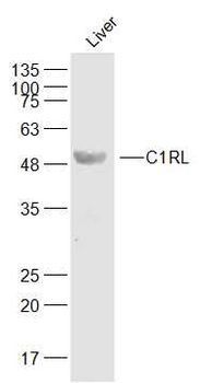 C1RL Rabbit Polyclonal Antibody
