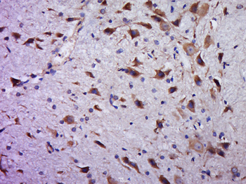 C20orf94 Rabbit Polyclonal Antibody