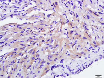 C21orf33 Rabbit Polyclonal Antibody