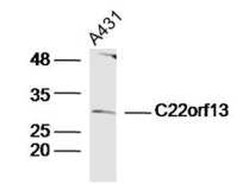 C22orf13 Rabbit Polyclonal Antibody