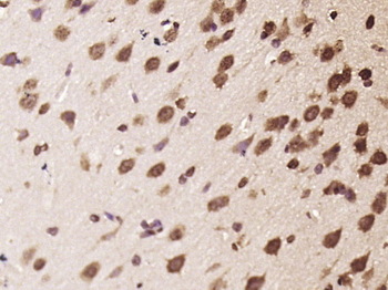 C22orf43 Rabbit Polyclonal Antibody