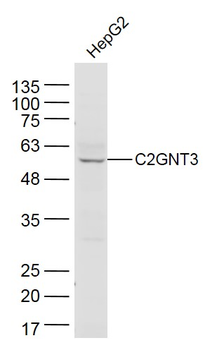C2GNT3 Rabbit Polyclonal Antibody