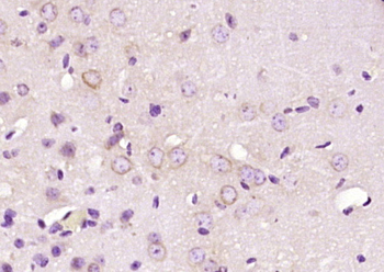 C2orf76 Rabbit Polyclonal Antibody