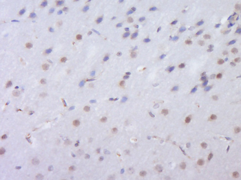 C2orf80 Rabbit Polyclonal Antibody