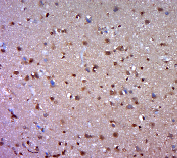 C3orf25 Rabbit Polyclonal Antibody