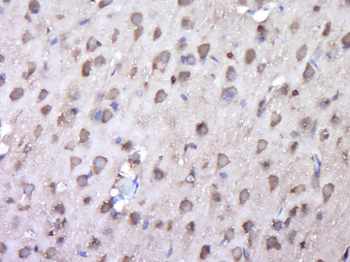 C5ORF44 Rabbit Polyclonal Antibody