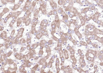 C6orf145 Rabbit Polyclonal Antibody