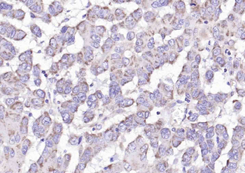 C6orf145 Rabbit Polyclonal Antibody