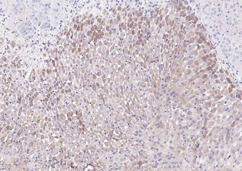C6orf145 Rabbit Polyclonal Antibody
