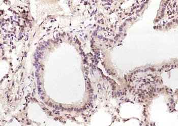 C6orf201 Rabbit Polyclonal Antibody