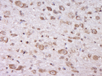 C6orf203 Rabbit Polyclonal Antibody