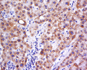 C6orf222 Rabbit Polyclonal Antibody