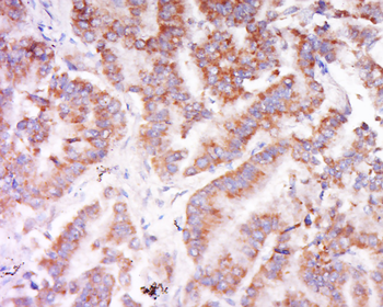 C6orf222 Rabbit Polyclonal Antibody