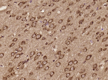 C6orf70 Rabbit Polyclonal Antibody