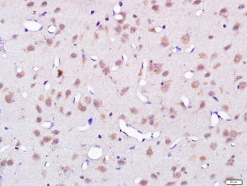 C7orf16 Rabbit Polyclonal Antibody