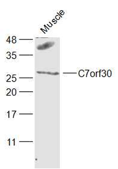 C7orf30 Rabbit Polyclonal Antibody