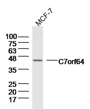 C7orf64 Rabbit Polyclonal Antibody