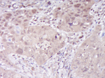 C7orf65 Rabbit Polyclonal Antibody