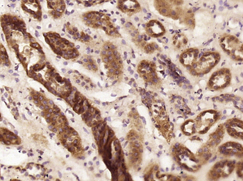 C8orf12 Rabbit Polyclonal Antibody