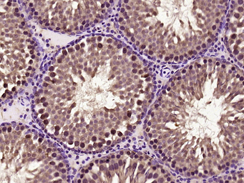 C8orf58 Rabbit Polyclonal Antibody