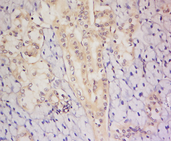 C8orf72 Rabbit Polyclonal Antibody