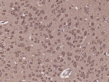 C8orf84 Rabbit Polyclonal Antibody