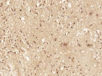 C8orf86 Rabbit Polyclonal Antibody