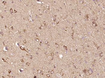 C9orf131 Rabbit Polyclonal Antibody