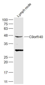 C9orf140 Rabbit Polyclonal Antibody