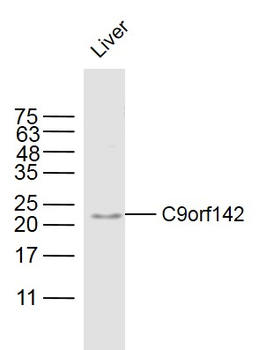 C9orf142 Rabbit Polyclonal Antibody