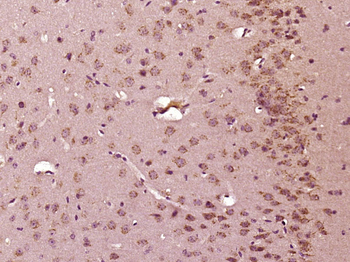 C9orf172 Rabbit Polyclonal Antibody
