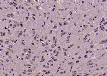 CABP1 Rabbit Polyclonal Antibody