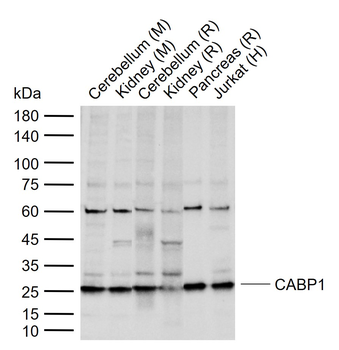 CABP1 Rabbit Polyclonal Antibody