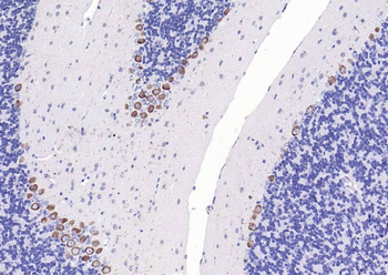 CACNA1G + CACNA1H Rabbit Polyclonal Antibody