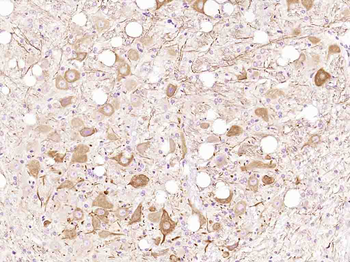 Calcipressin 3 Rabbit Polyclonal Antibody